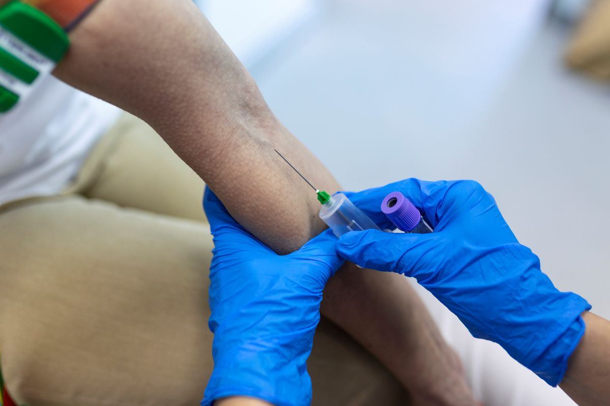 Arteriovenous Fistula Treatment